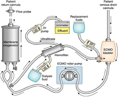 Adjunctive Therapies During Extracorporeal Membrane Oxygenation to Enhance Multiple Organ Support in Critically Ill Children